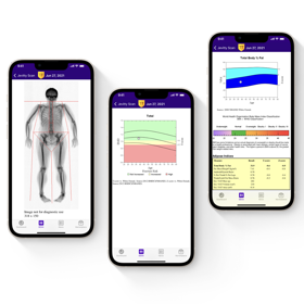 Hologic DEXA scan medical images and summary of body composition scan data for the Jevitty App, User Dashboard with Health Data.