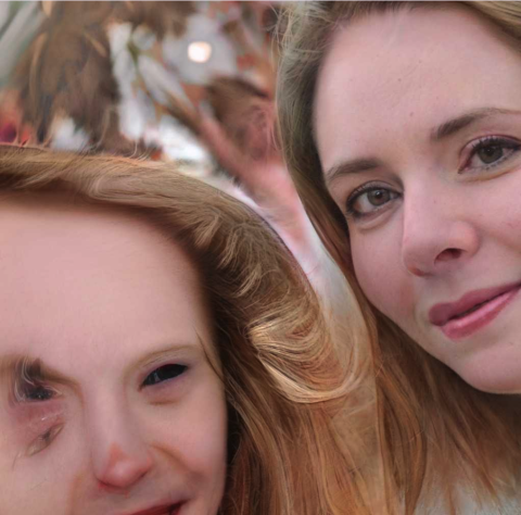 Facial feature anomalies