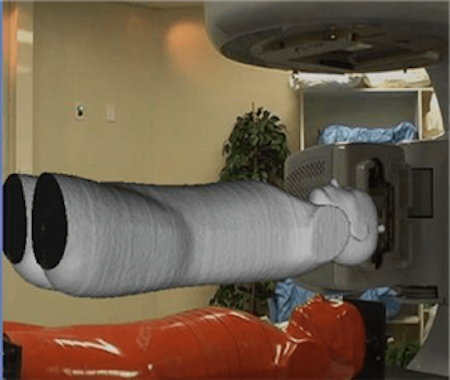 Positioning for radiotherapy