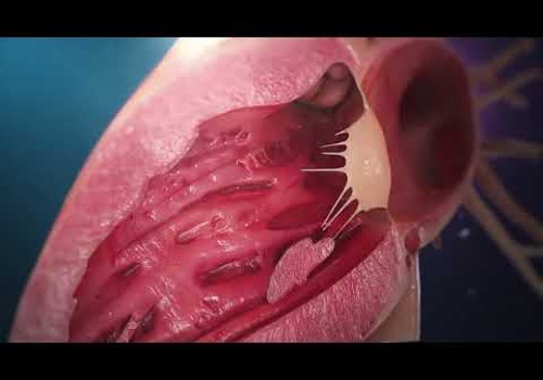 Video Marketing Package Example: Medical Heart Animation: High-Fidelity Cardiac