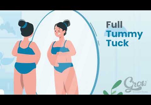 Video Production Package Example: Liposuction Animated Promotional Video