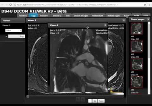 Custom Software Development Package Example: Radiology Imaging Mobile Responsive DICOM Viewer
