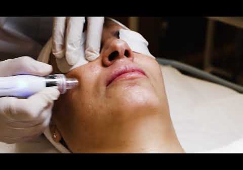 Advertising Package Example: Digital