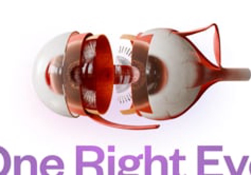 UX/UI Design Package Example: Interactive 3D models for treatment planning