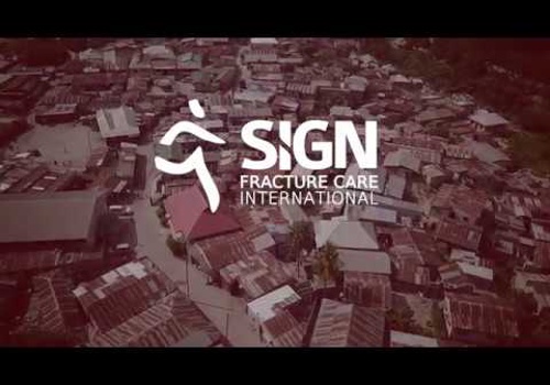 Video Production Package Example: "Creating Equality of Fracture Care" SIGN Tanzania