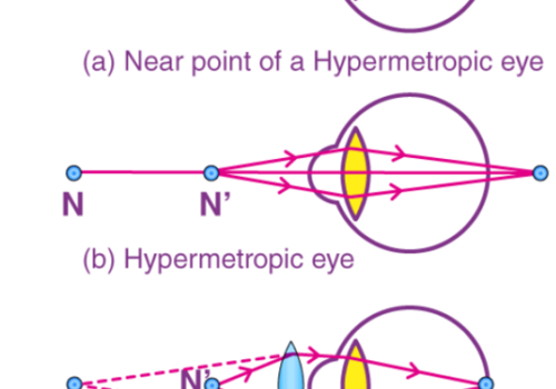 AR/VR Development Package Example: Eyesight correction in VR
