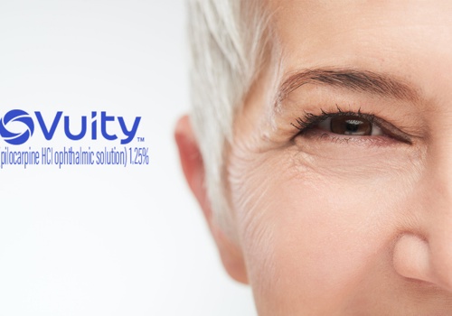 Branding Package Example: Vuity: Naming a medication for Allergan