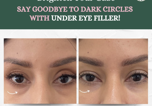 Social Media Marketing Package Example: ROAS OF 23X AND BRAND GROWTH BY 120%