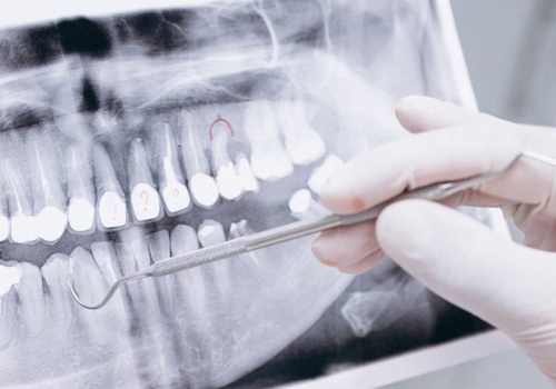 Search Engine Optimization Package Example: PPC, SEO & Socials for the Dental Clinic