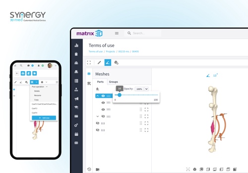 Custom Software Development Package Example: Application for printing customized 3D models for