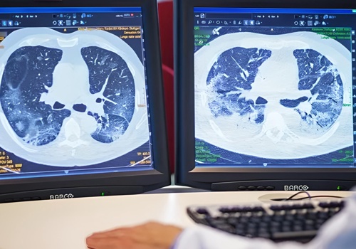 AI Development Package Example: Solutions for the governmental body