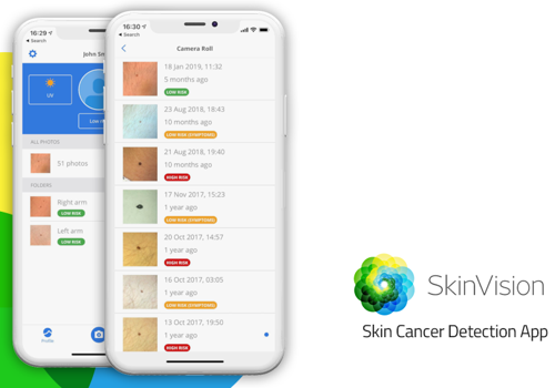 Mobile App Development Package Example: SkinVision - Skin Cancer Melanoma Detection App